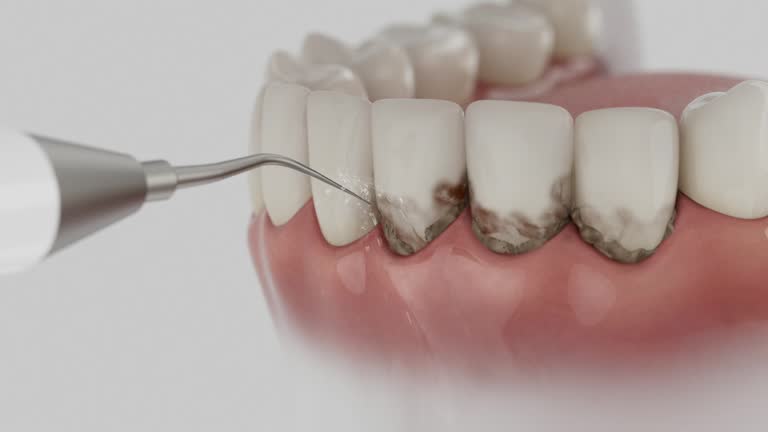 Reliable Dental contractor in Stonebridge, NJ by Smile Center Dentistry